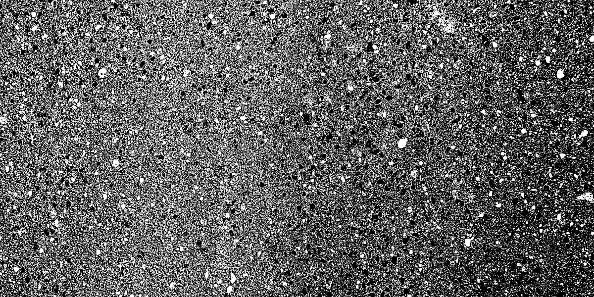 Guaranteed Erectile Dysfunction Treatment: Exploring Effective Solutions