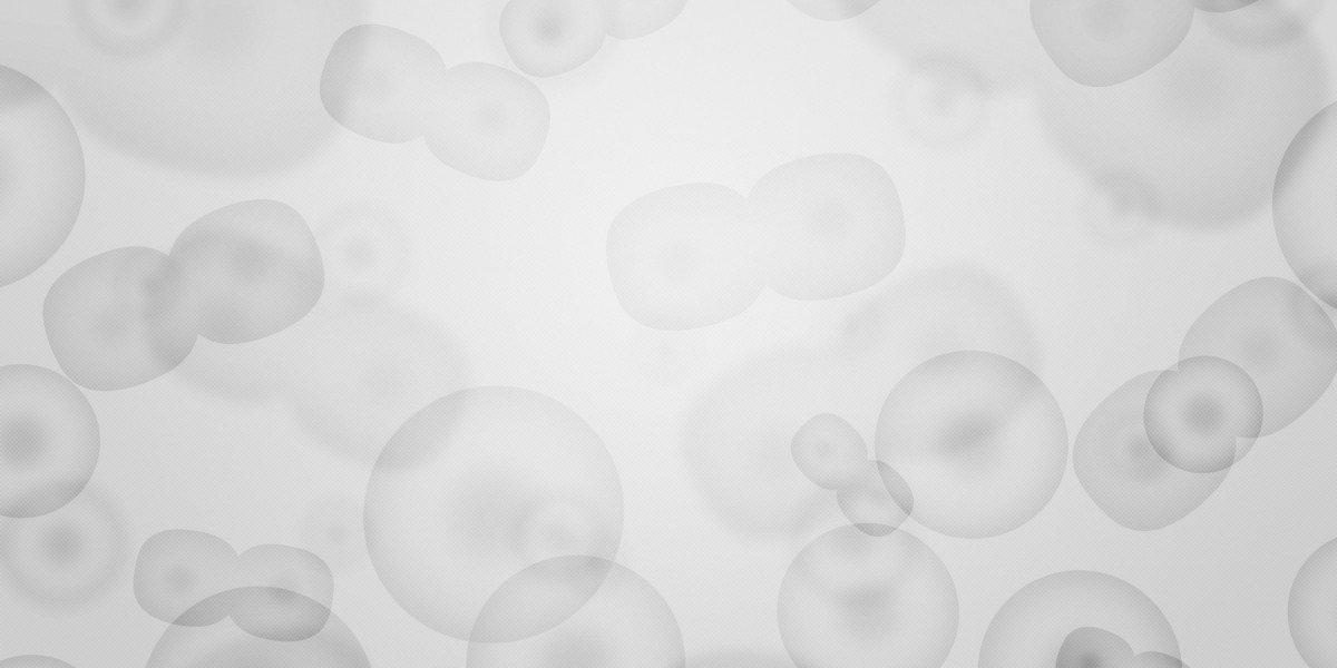 Investing In Gold IRA: A Comprehensive Case Study